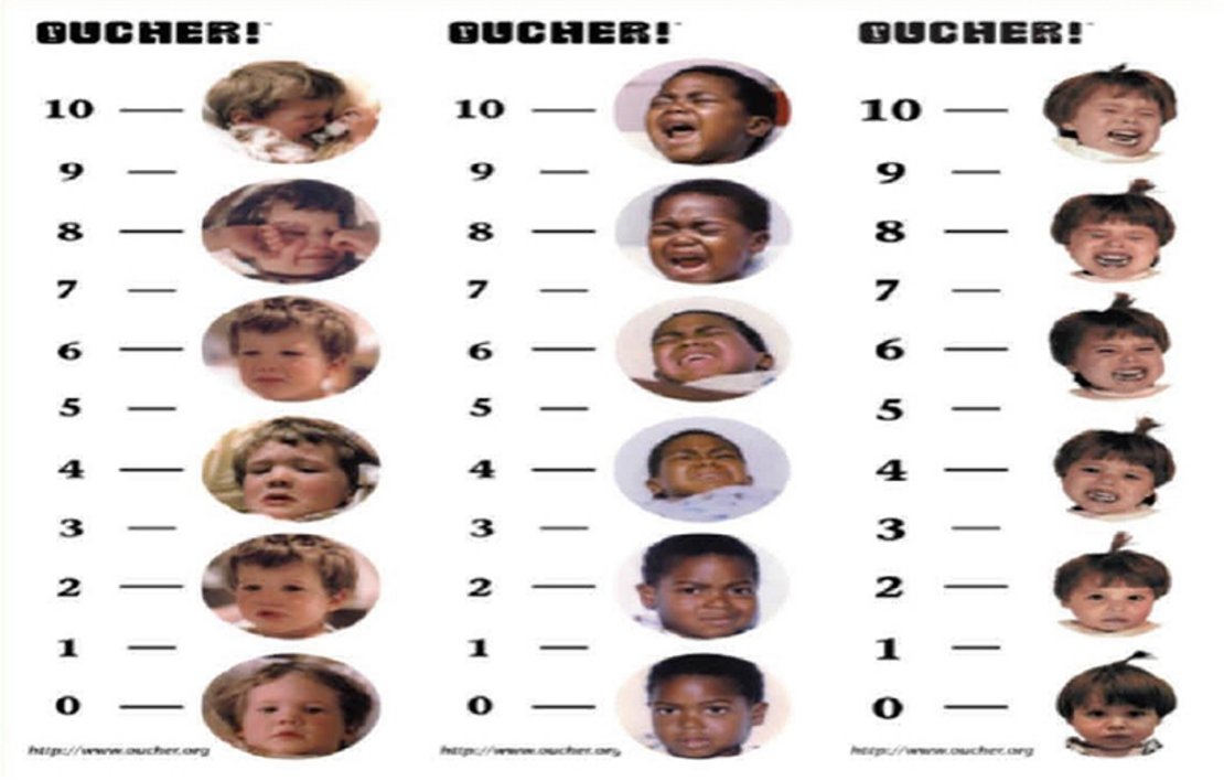 Oucher Child Pain Assessment Scale
