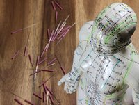 Metaanalyse untersucht Wirksamkeit der Akupunktur bei Schmerz