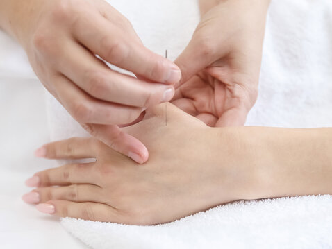 Neuropathie nach Chemotherapie: Hilft Akupunktur?
